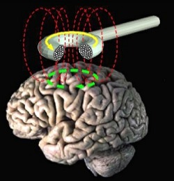 Brain stimulate