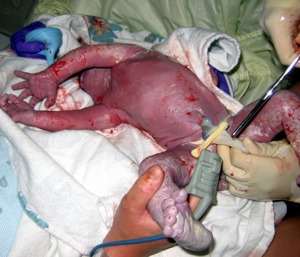 Stem-Cells
