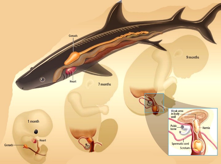 Hernias